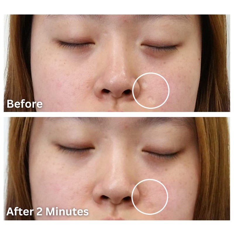 Dermaflage Scar Filler, Refill Applicator - Image 5